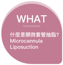 WHAT 什麼是顯微套管抽脂Microcannula liposuction？