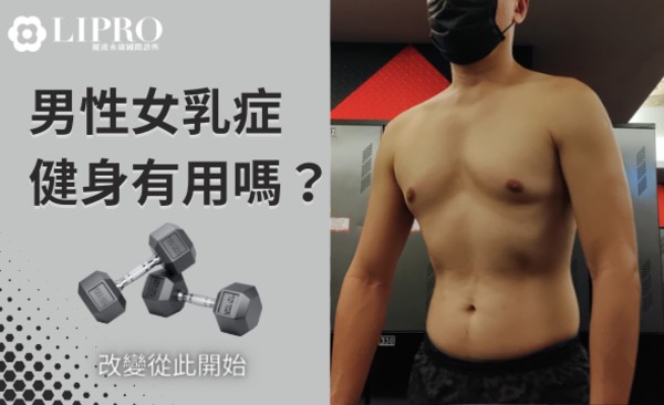 男性女乳症案例分享