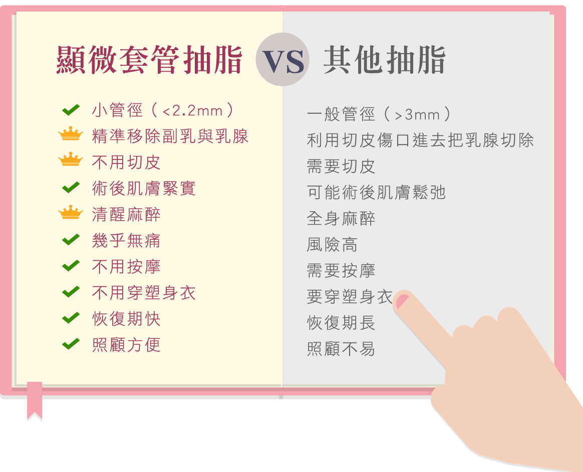 顯微套管抽脂 VS 其他抽脂