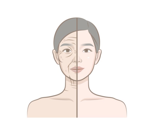 Thermage vs. Morpheus8 vs. Ulthera vs. Renuvion vs. BodyTite：不同能量治療原理、溫度層次與效果解析