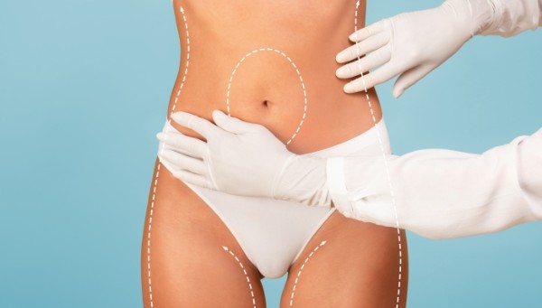 韓國抽脂dcard真相？腹部抽脂失敗怎麼辦？麗波成功修復經驗談