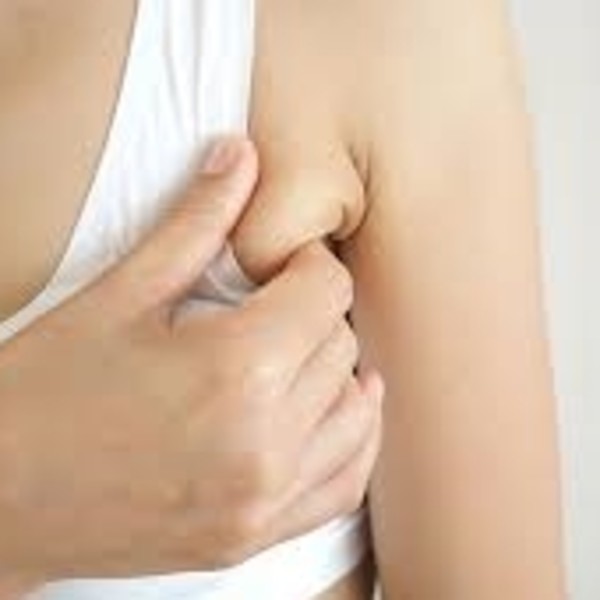 腋下副乳是什麼？為什麼會有副乳？副乳長怎樣？3大關鍵一次解答！