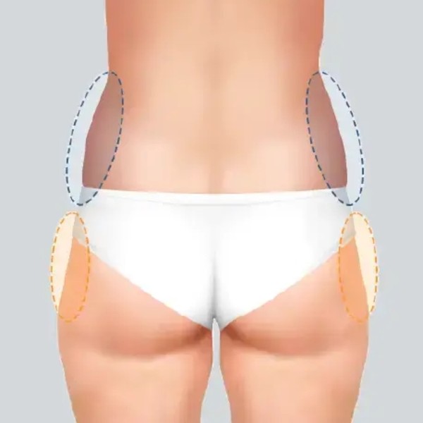 屁股兩側凹陷原因？屁股大怎麼消？蝴蝶臀改善4大重點一次看