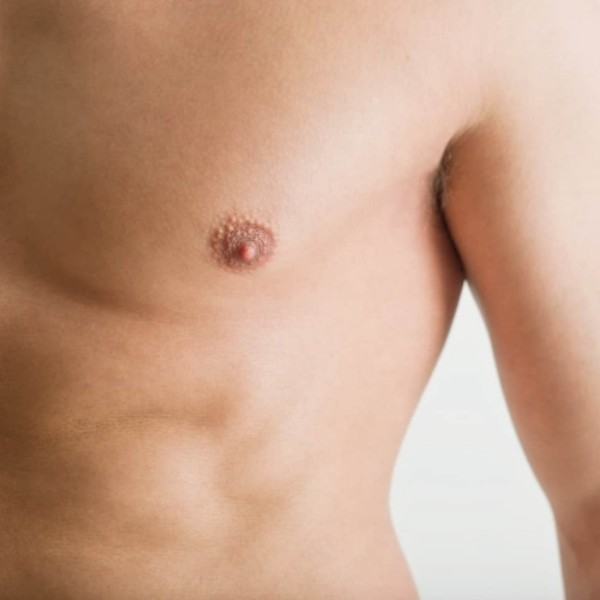 男性胸部硬塊會痛？3分鐘搞懂男性女乳症會不會自己好？