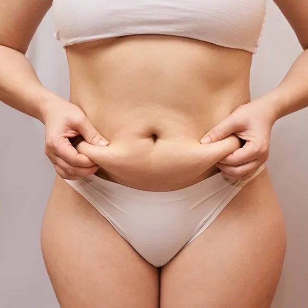 贅皮只能靠手術嗎？2026最新非手術緊膚法比較｜減肥皮鬆怎麼辦一次看懂