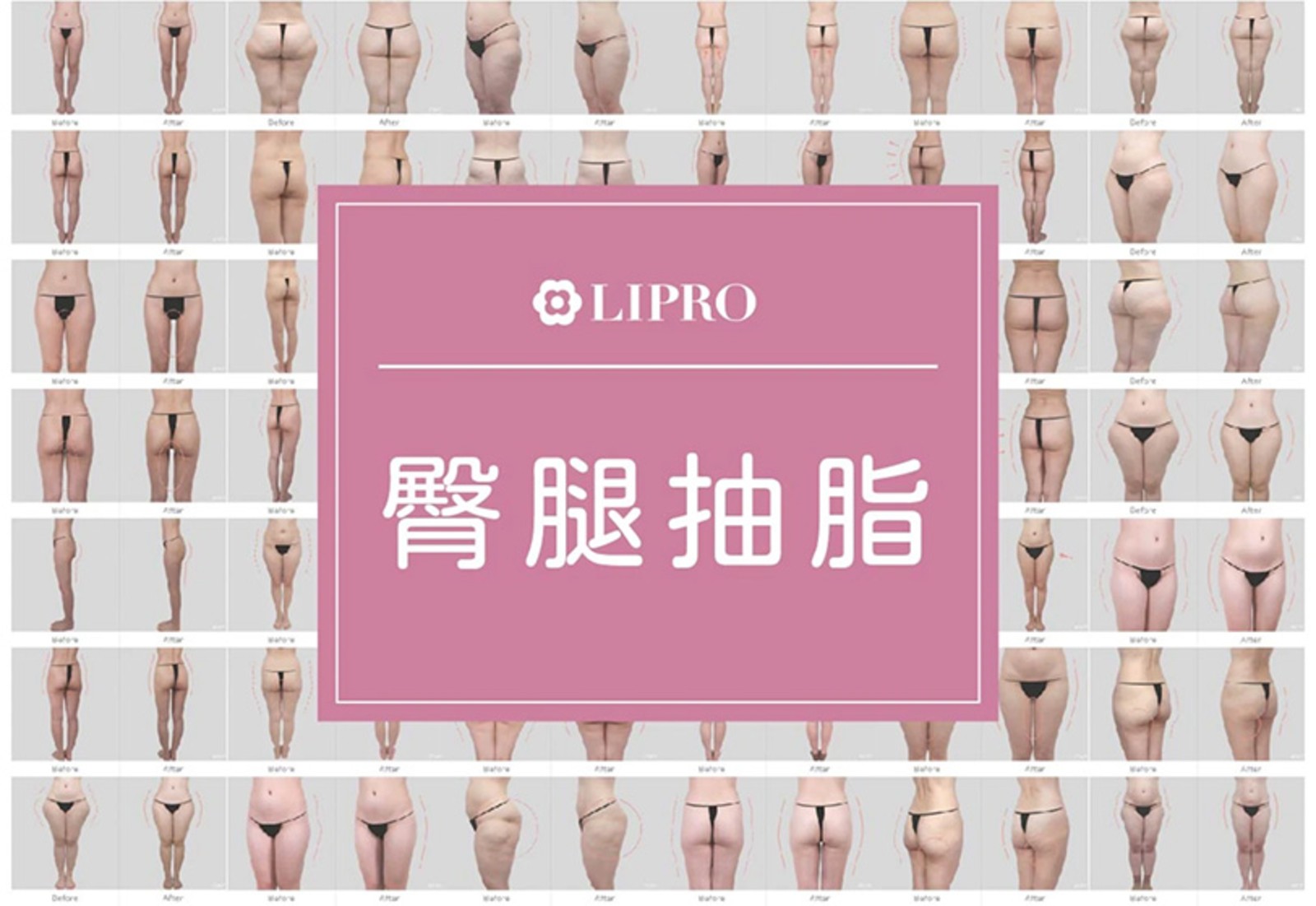 臀腿案例 口碑見證