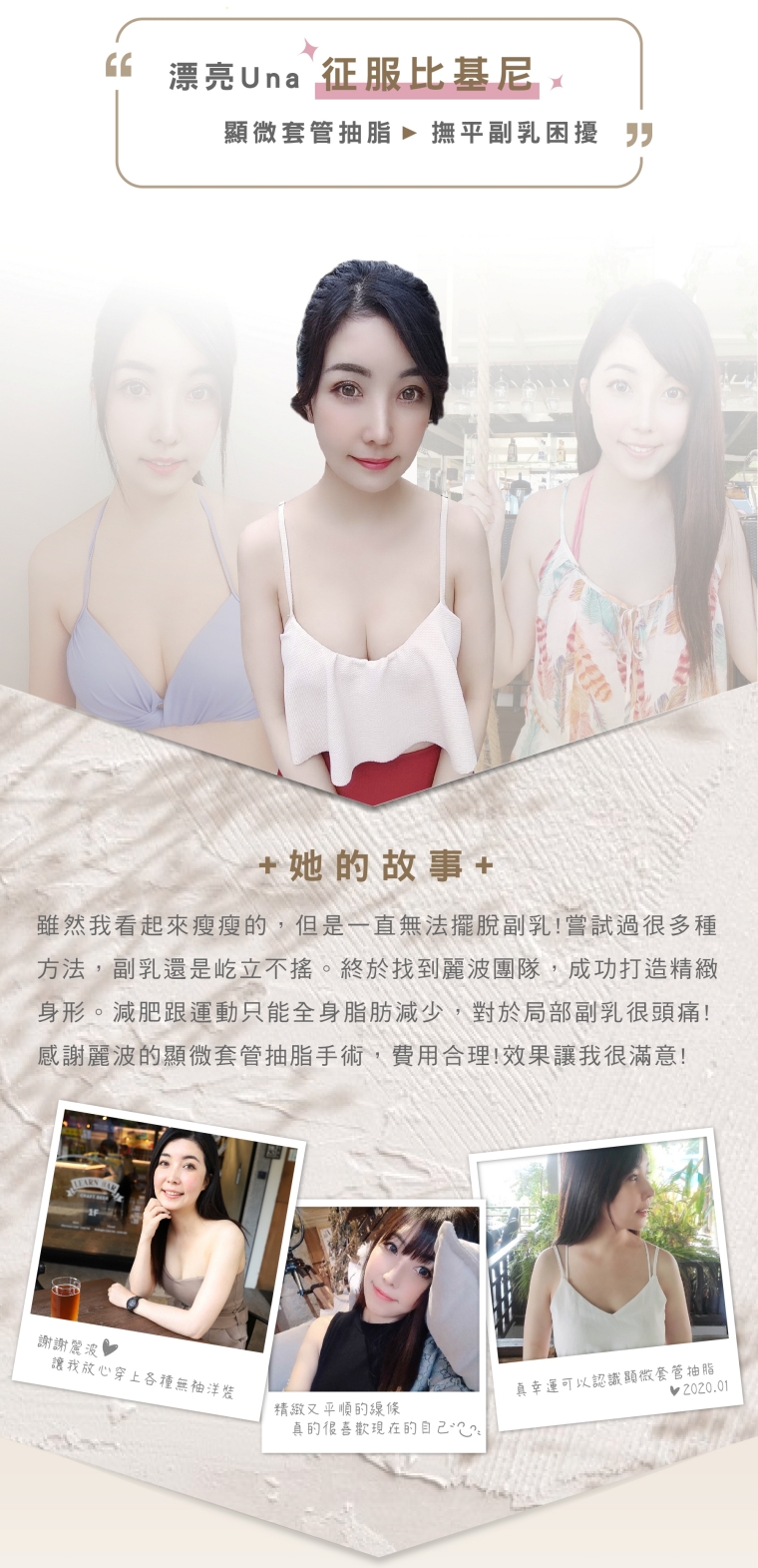副乳手術_副乳抽脂_顯微套管抽脂_副乳消除