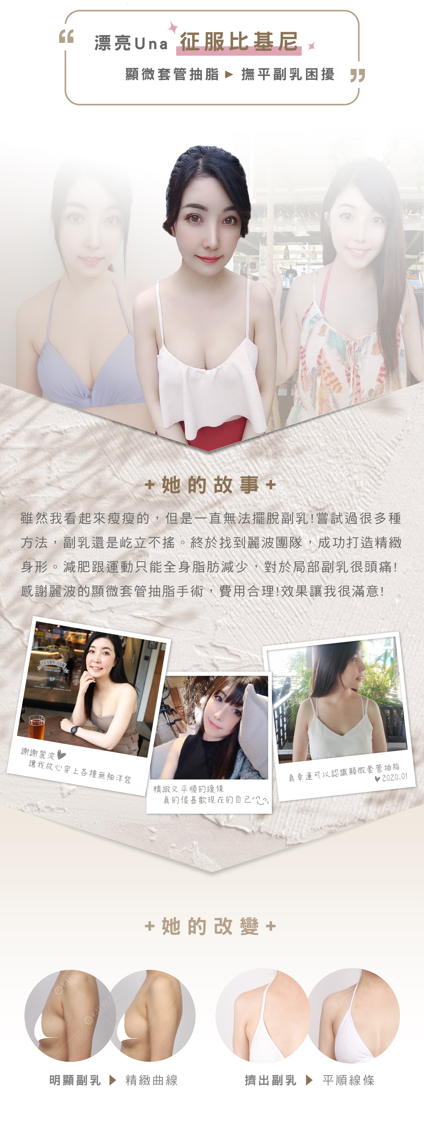 漂亮Una征服比基尼,顯微套管抽脂,撫平副乳困擾