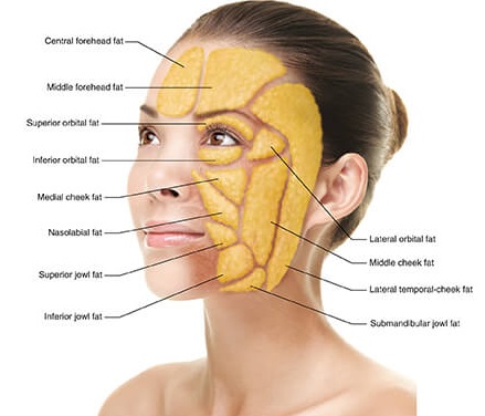 饅化臉修復,玻尿酸饅化,醫美饅化,饅化有救嗎