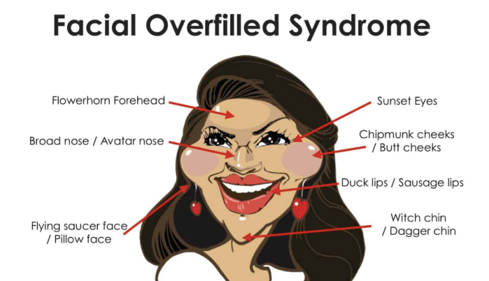 饅化臉修復,玻尿酸饅化,醫美饅化,饅化有救嗎