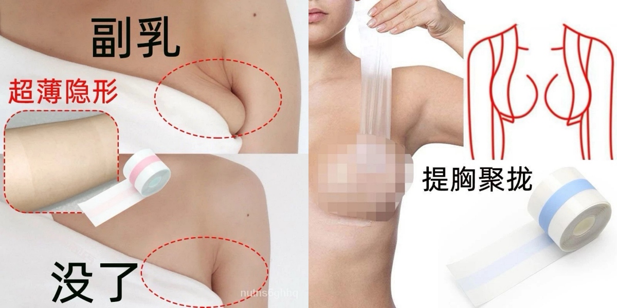 副乳消除貼有用嗎醫學說明
