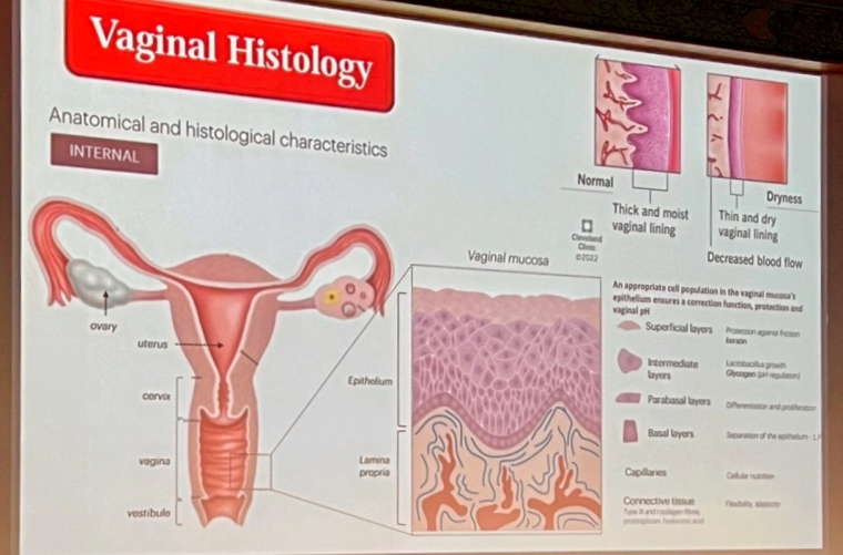 大陰脣補脂,私密處緊實,陰唇手術,大陰脣手術