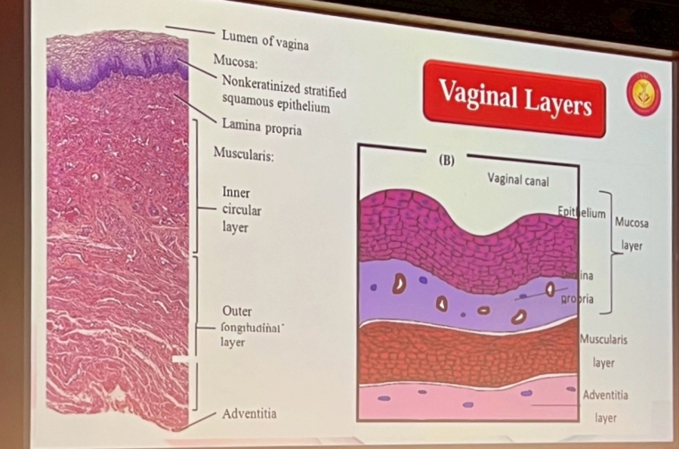 大陰脣補脂,私密處緊實,陰唇手術,大陰脣手術