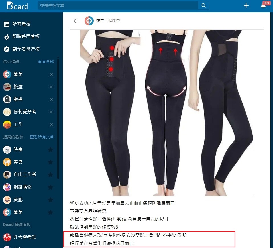 抽脂塑身衣,手臂抽脂塑身衣,抽脂塑身衣穿多久,抽脂塑身衣有用嗎,抽脂塑身衣穿多久dcard