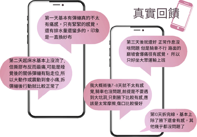男性女乳症dcard網友滿意度回饋