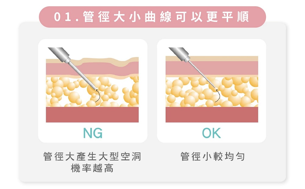 大腿外側凸一塊,大腿外側怎麼瘦,大腿外側肌肉,大腿外側