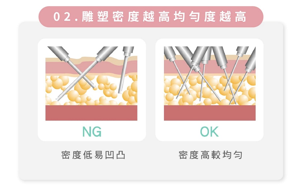 大腿外側凸一塊,大腿外側怎麼瘦,大腿外側肌肉,大腿外側