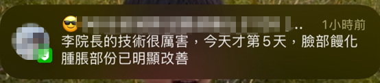 饅化修復案例