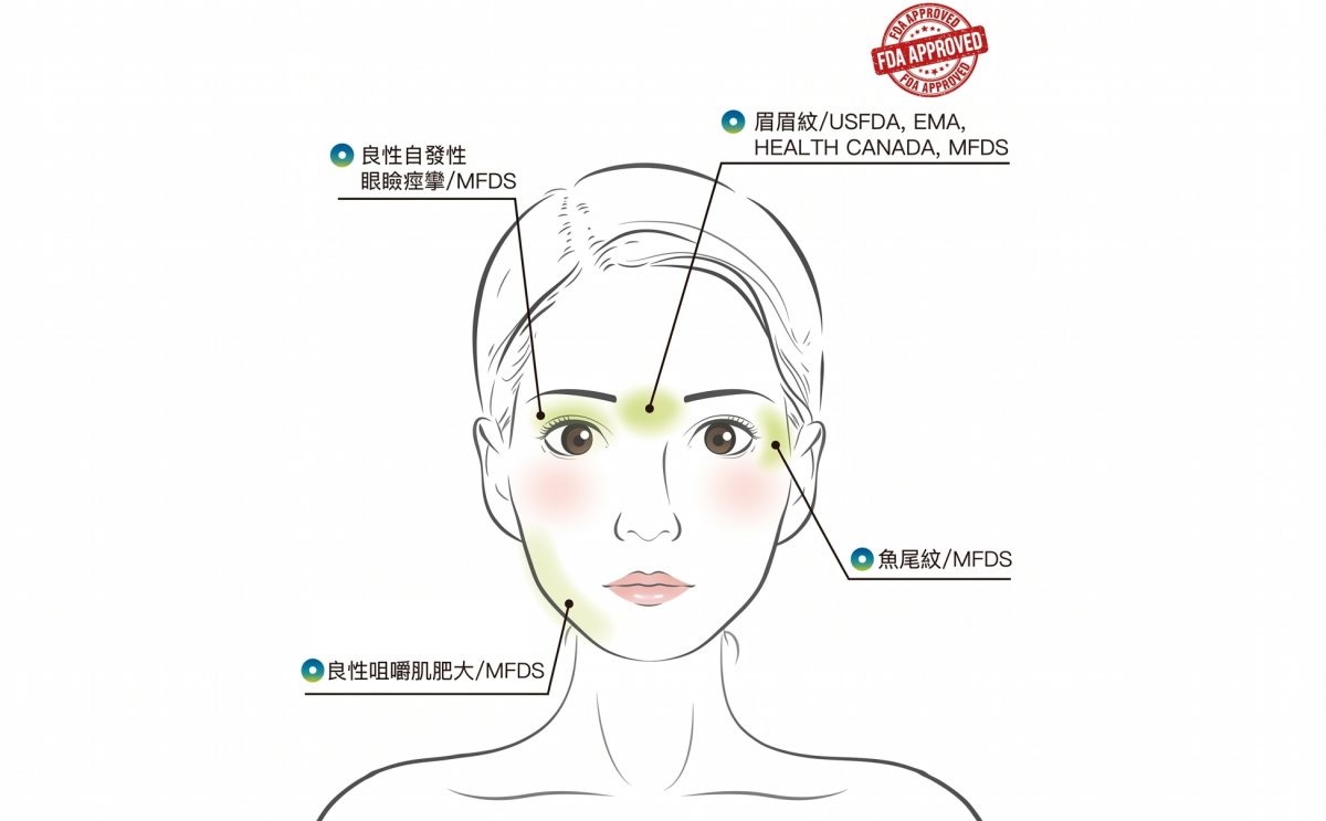 彩虹肉毒,Nabota價格,彩虹肉毒dcard,彩虹肉毒保妥適比較