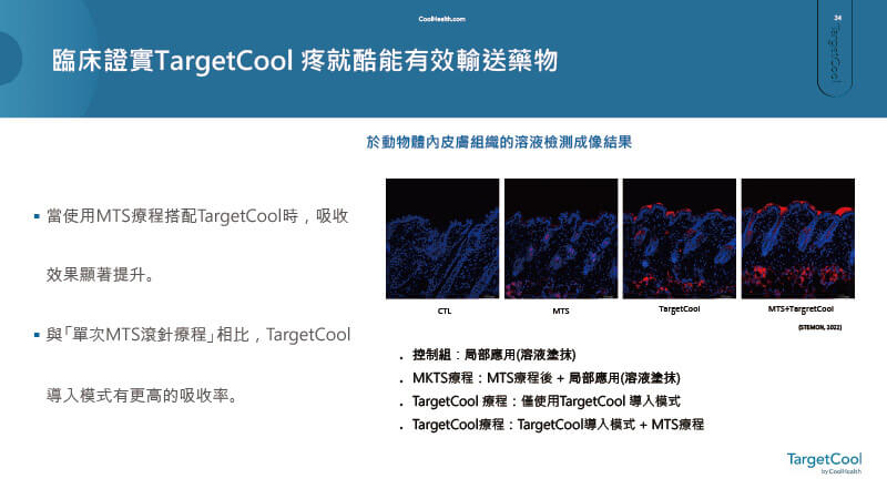 臨床影像顯示TargetCool與MTS療程搭配使用可提升藥物導入效率與吸收深度