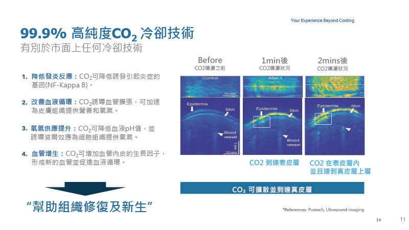 TargetCool利用高純度CO₂冷卻技術，提升血液循環與細胞活性，有助於組織修復與再生