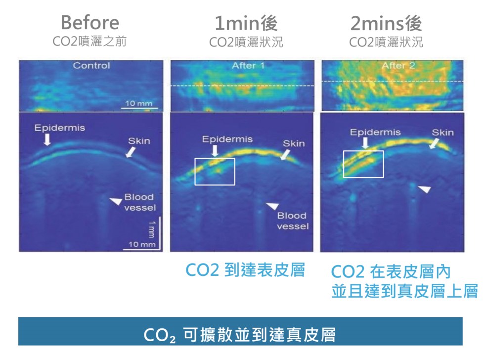 疼就酷費用,疼就酷dcard,Targetcool效果,targetcool疼就酷