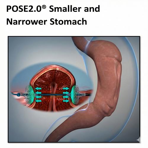 猛健樂沒瘦,打猛健樂沒瘦,猛健樂復胖,猛健樂沒效