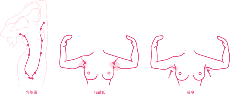  副乳怎麼消,快速消副乳dcard,副乳按摩,副乳運動,副乳內衣,副乳怎麼消dcard