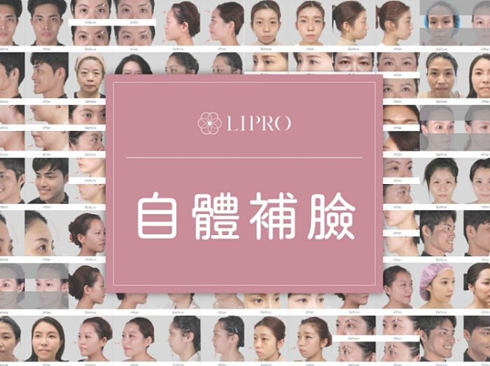 自體脂肪術後保養,手術多久可以喝酒,補脂後悔dcard