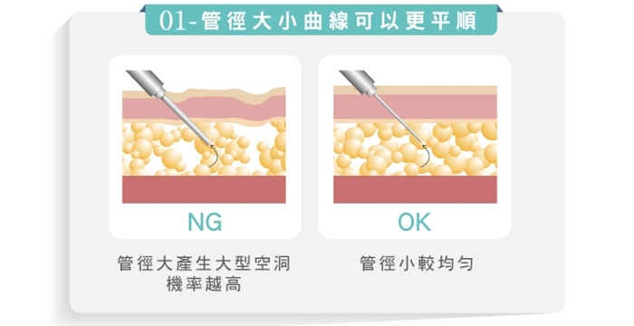 抽脂後遺症ptt,抽脂後遺症,大腿抽脂後遺症,麗波永康國際診所