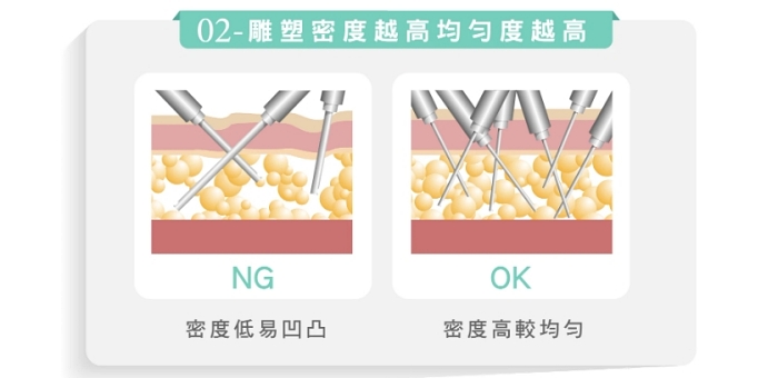 抽脂後遺症ptt,抽脂後遺症,大腿抽脂後遺症,麗波永康國際診所