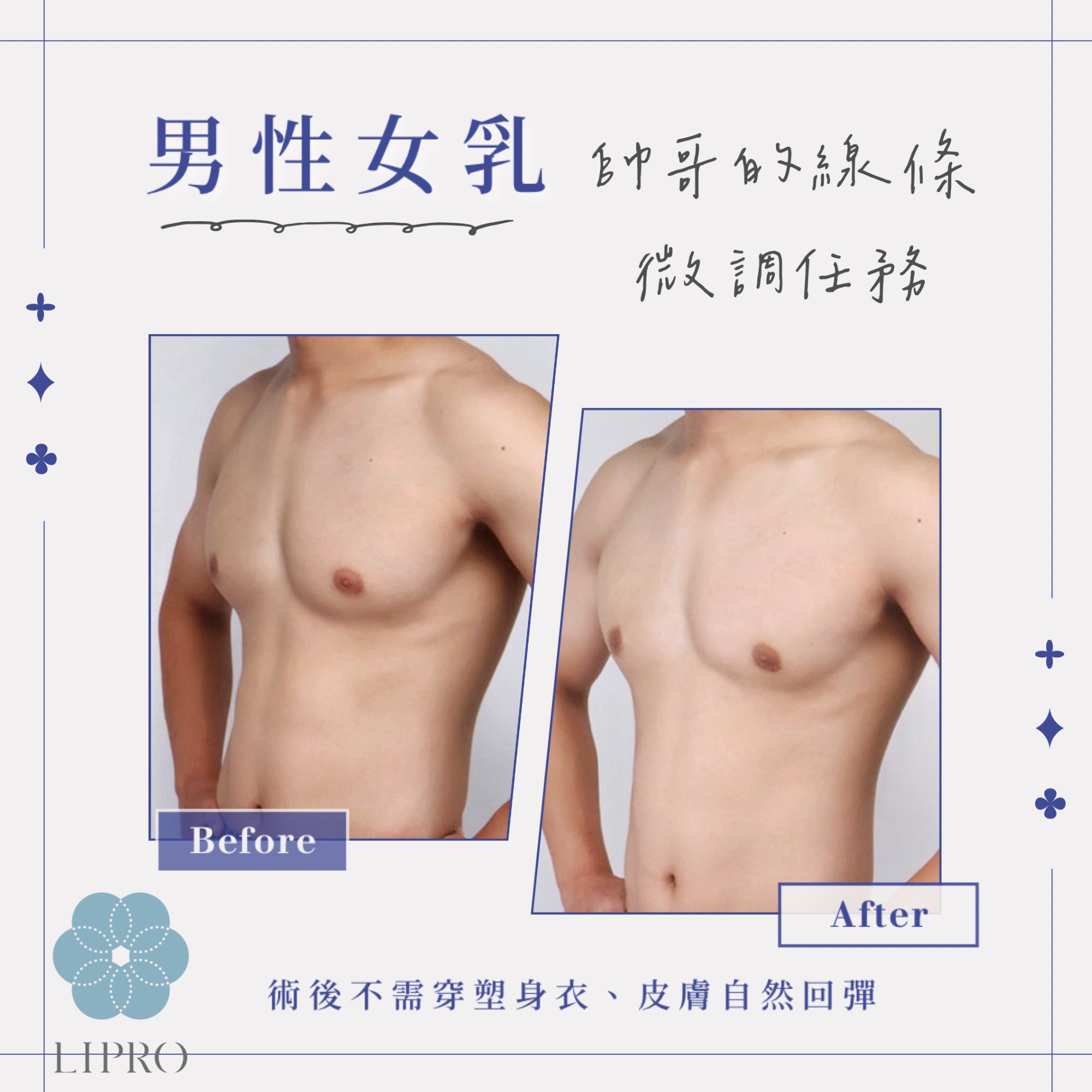 男生副乳怎麼減,男生有副乳嗎,男生副乳重訓,男生副乳怎麼消,男生副乳