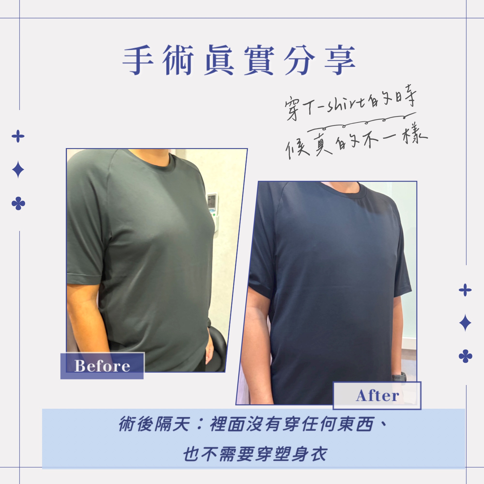男生副乳怎麼減,男生有副乳嗎,男生副乳重訓,男生副乳怎麼消,男生副乳