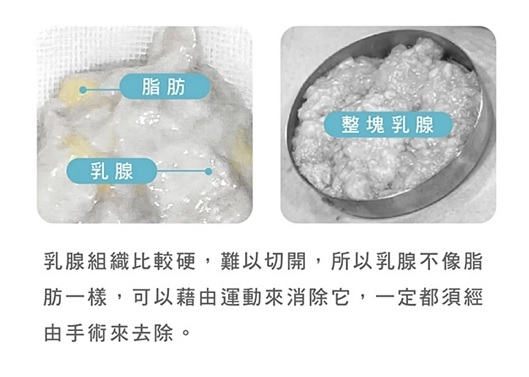 男生副乳怎麼減,男生有副乳嗎,男生副乳重訓,男生副乳怎麼消,男生副乳