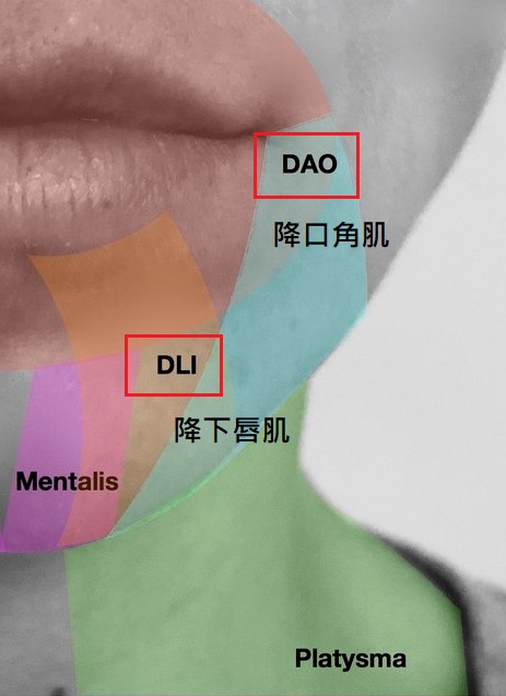 肉毒拉提下半臉,擴頸肌肉毒,頸闊肌肉毒,肉毒擴頸肌,肉毒拉提多久有效
