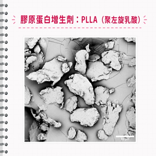 膠原蛋白增生劑比較,膠原蛋白增生劑品牌,膠原蛋白增生劑饅化,膠原蛋白增生劑dcard,膠原蛋白增生劑缺點
