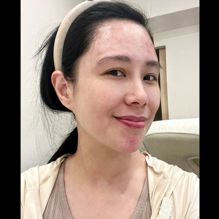 饅化有救嗎推薦李咏馨醫師
